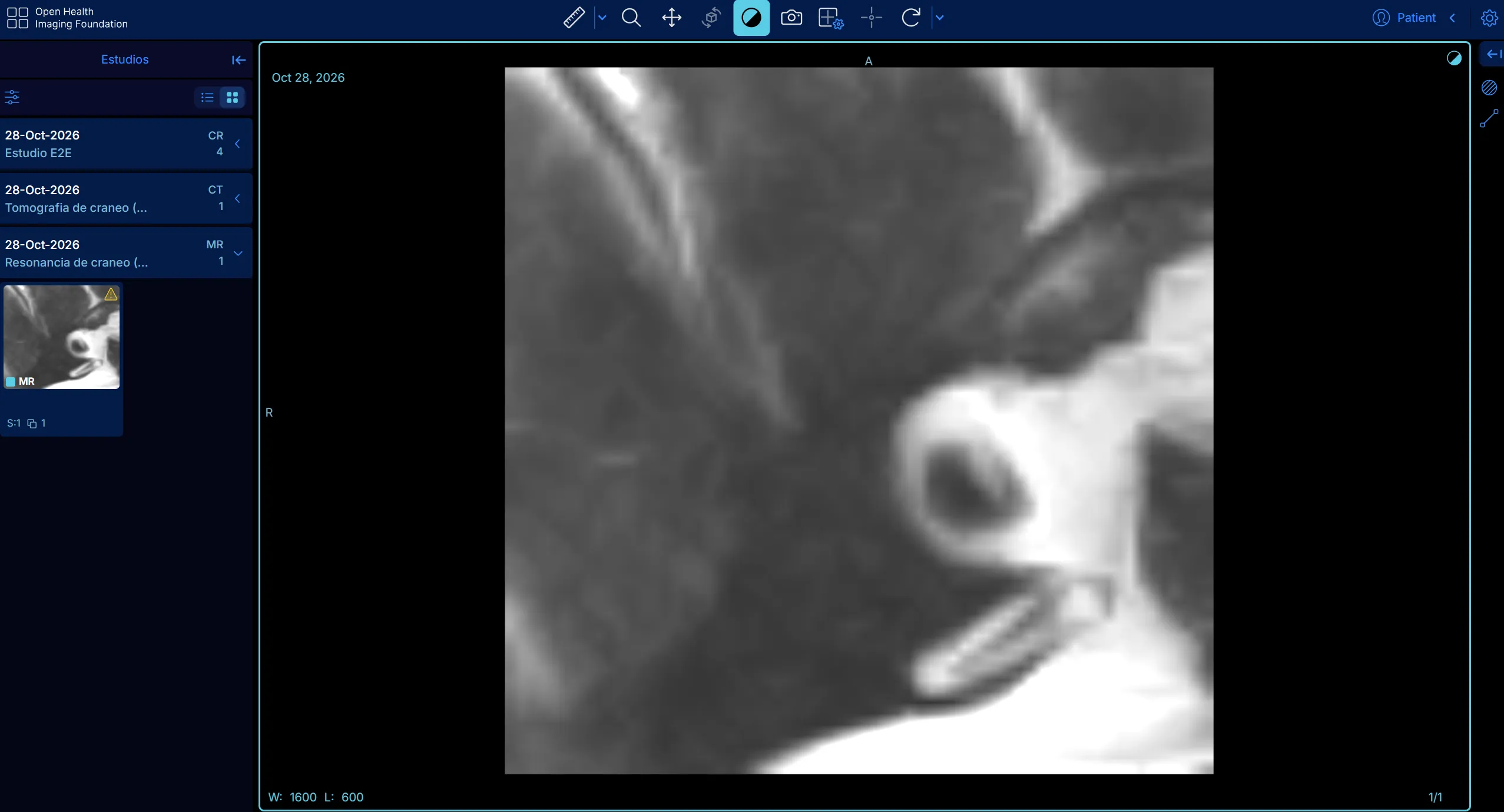 Visor de imágenes médicas con la lista de estudios del paciente a la izquierda, una resonancia de cráneo en pantalla y herramientas de medición, zoom, contraste y rotación